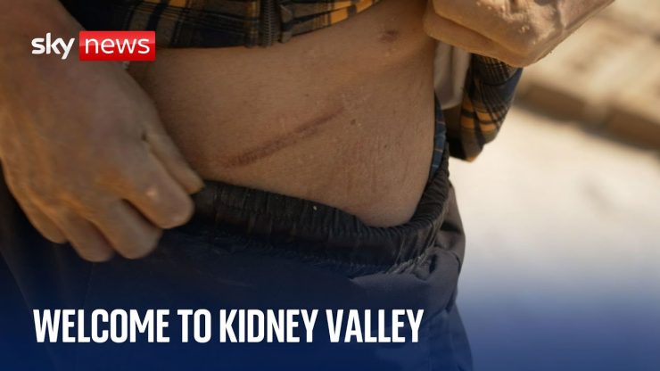 Nepali men return from Gulf States needing kidney transplants